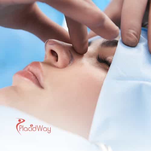Affordable Rhinoplasty in Istanbul: A Guide for London Patients
